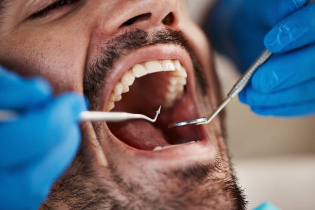 Best Broken Tooth Emergency  in Monroe Manor, NJ